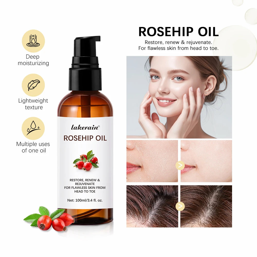 All In Rosehip