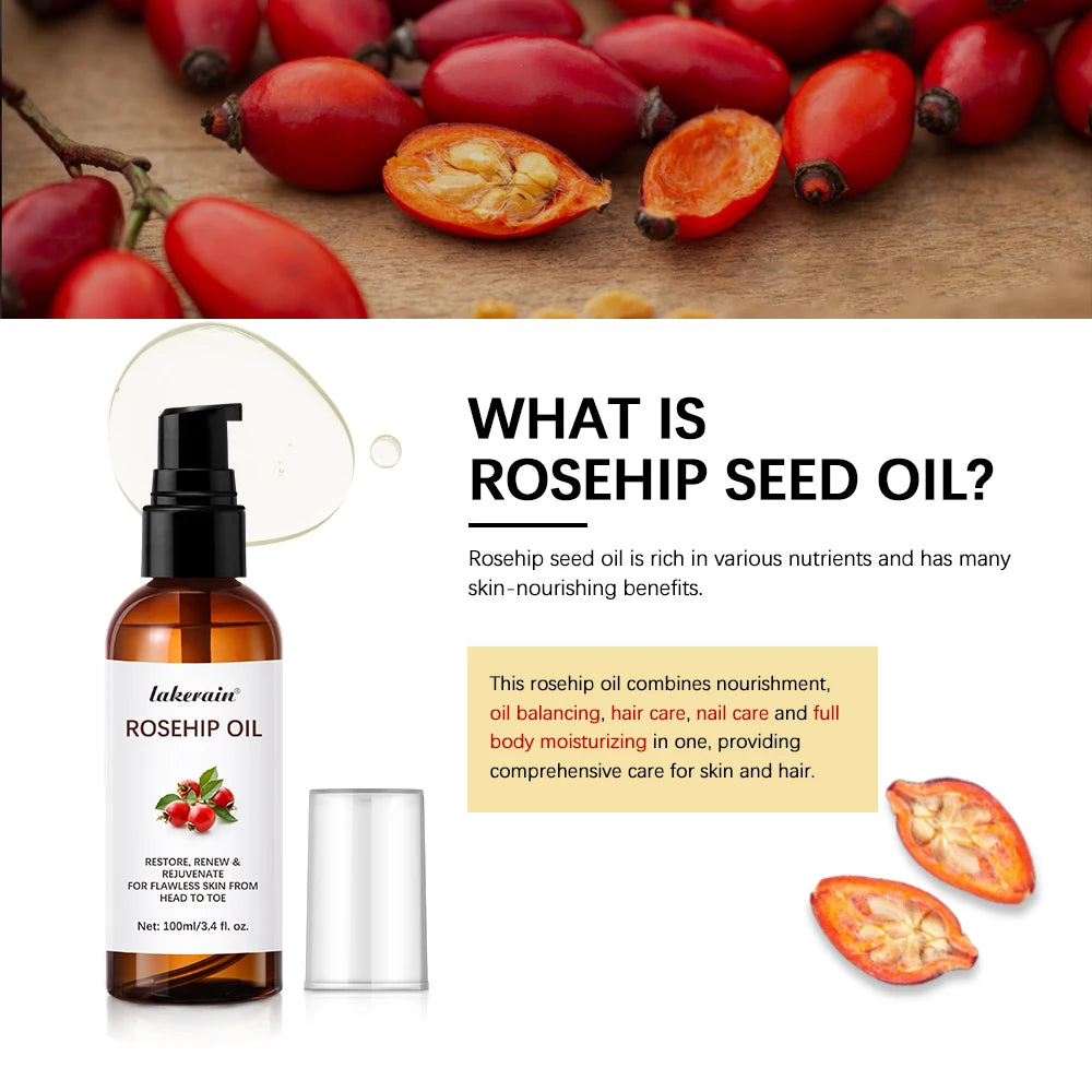 All In Rosehip
