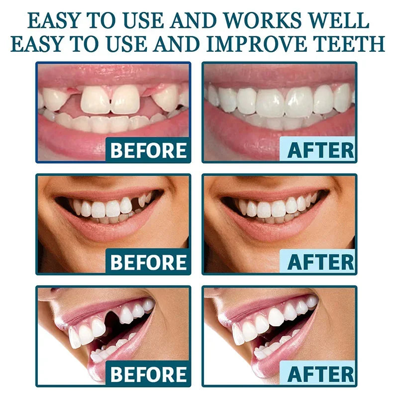 Perfect Teeth