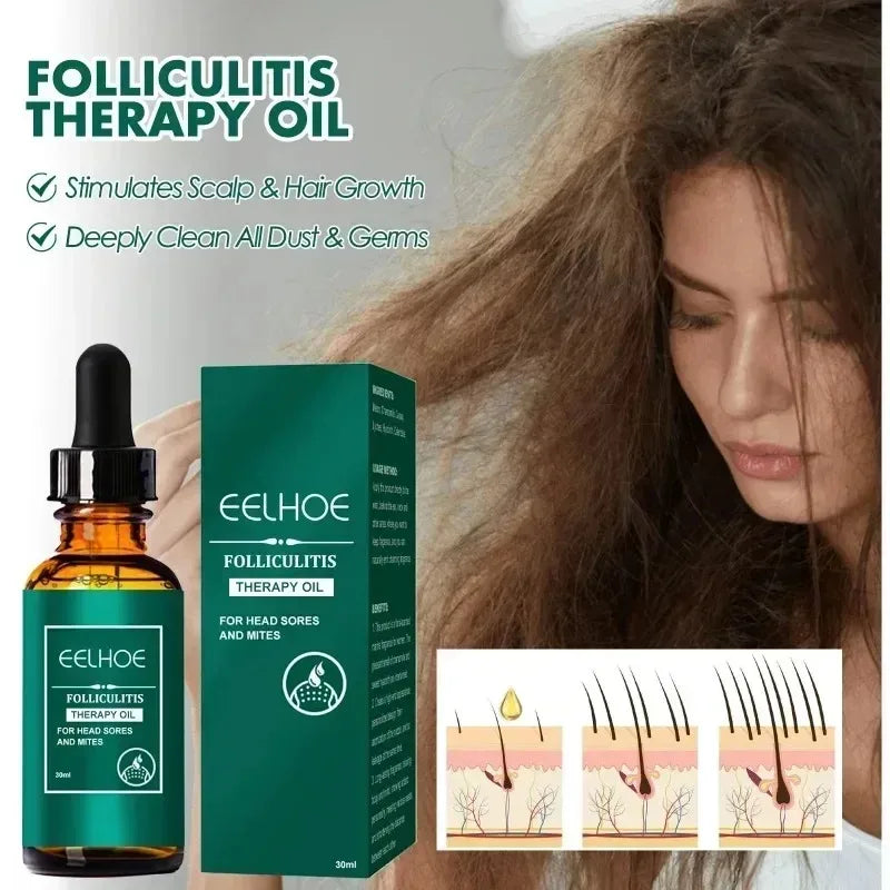 EEHOE Hair Revitalize