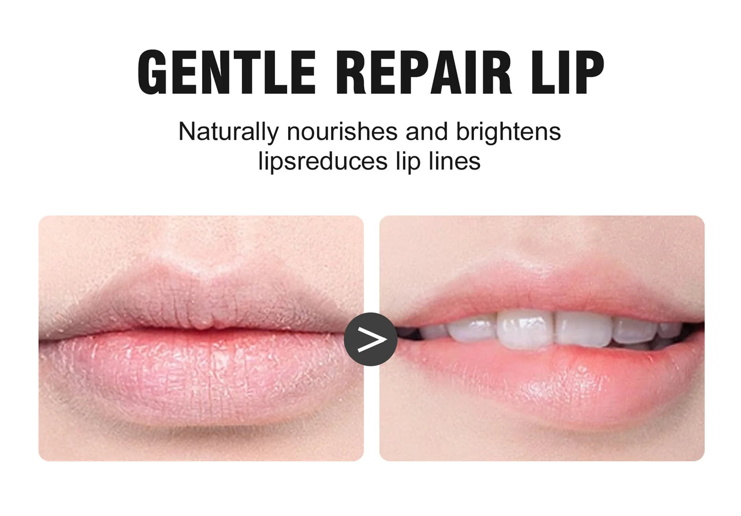 Lip Restore