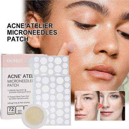 Micro-Needle Acne Patch