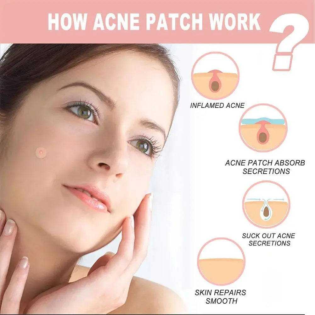 Micro-Needle Acne Patch