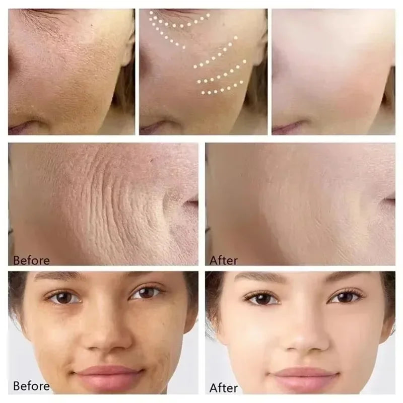 Caviar Lift