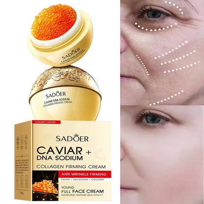 Caviar Lift