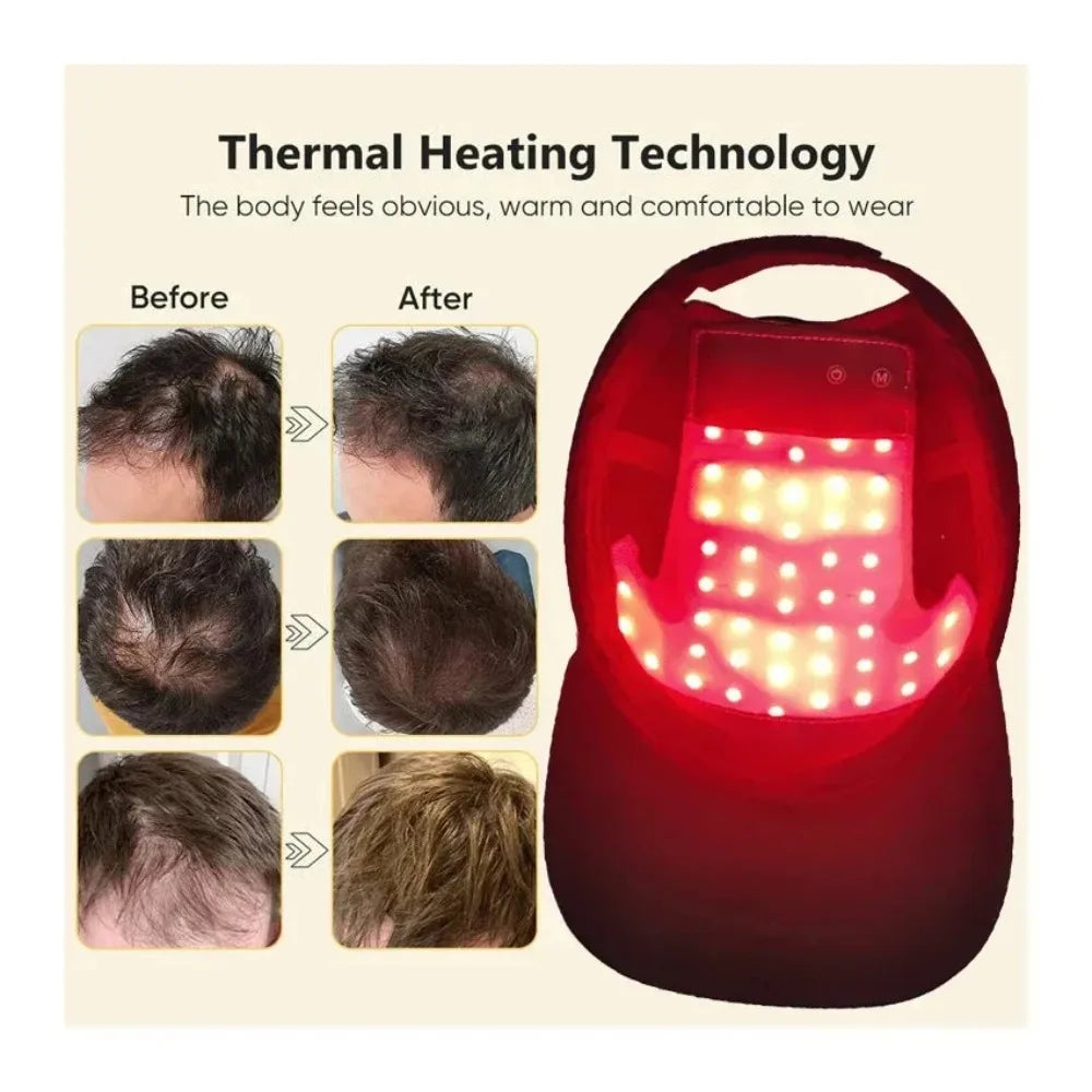 LuxCap Hair Regrowth