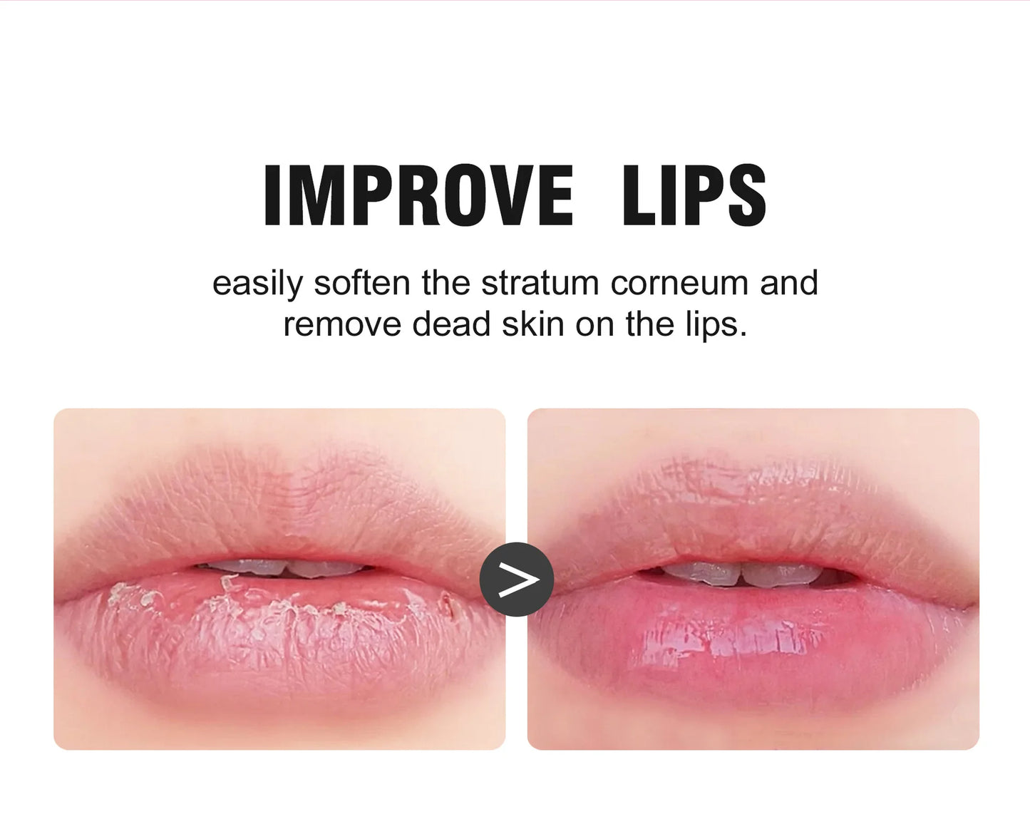 Lip Restore