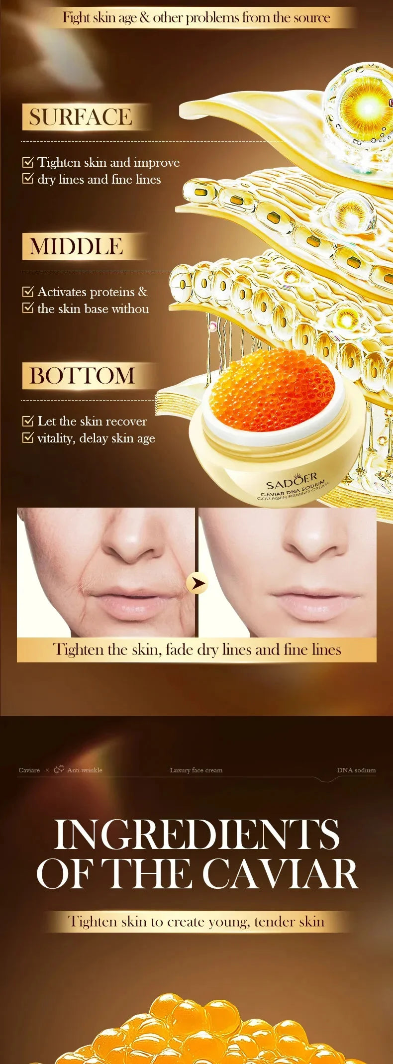 Caviar Lift