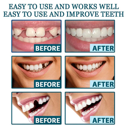 Perfect Teeth
