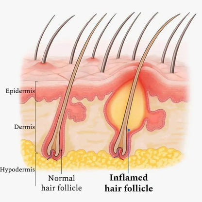 EEHOE Hair Revitalize