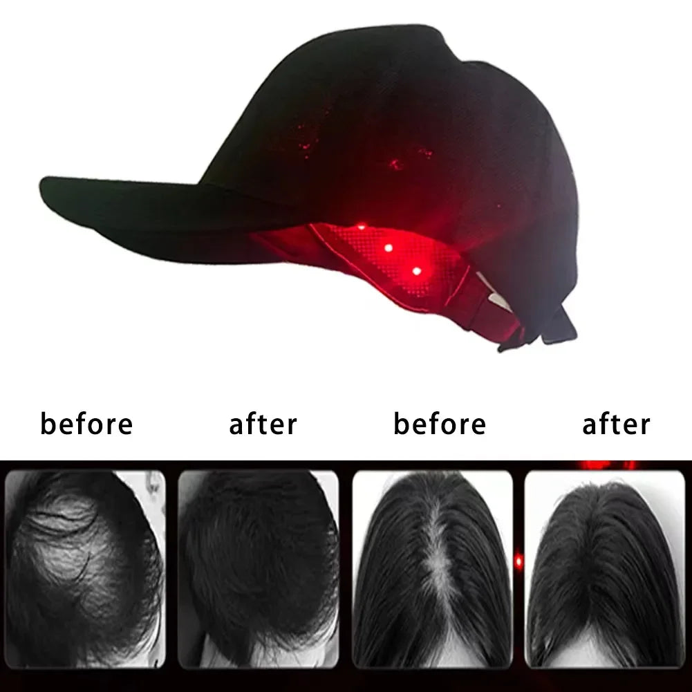 LuxCap Hair Regrowth