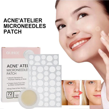 Micro-Needle Acne Patch