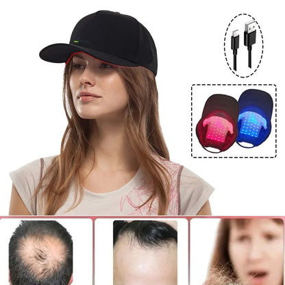 LuxCap Hair Regrowth