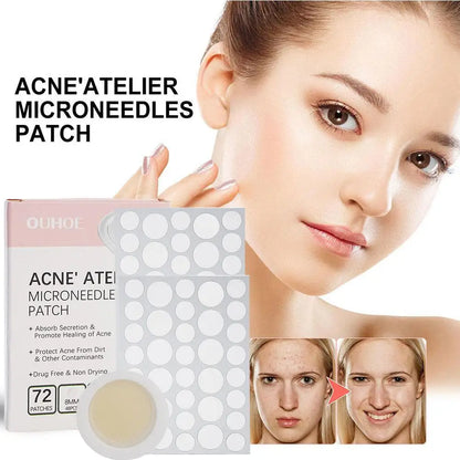 Micro-Needle Acne Patch