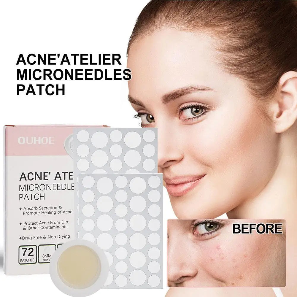 Micro-Needle Acne Patch