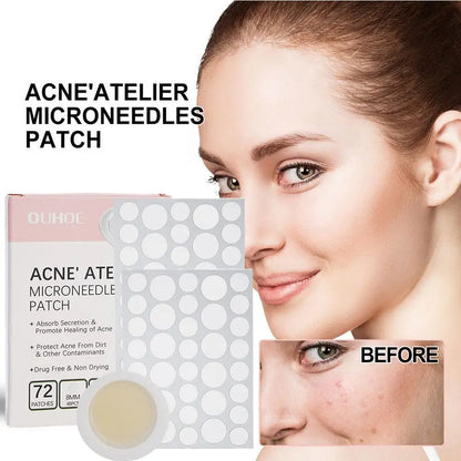 Micro-Needle Acne Patch