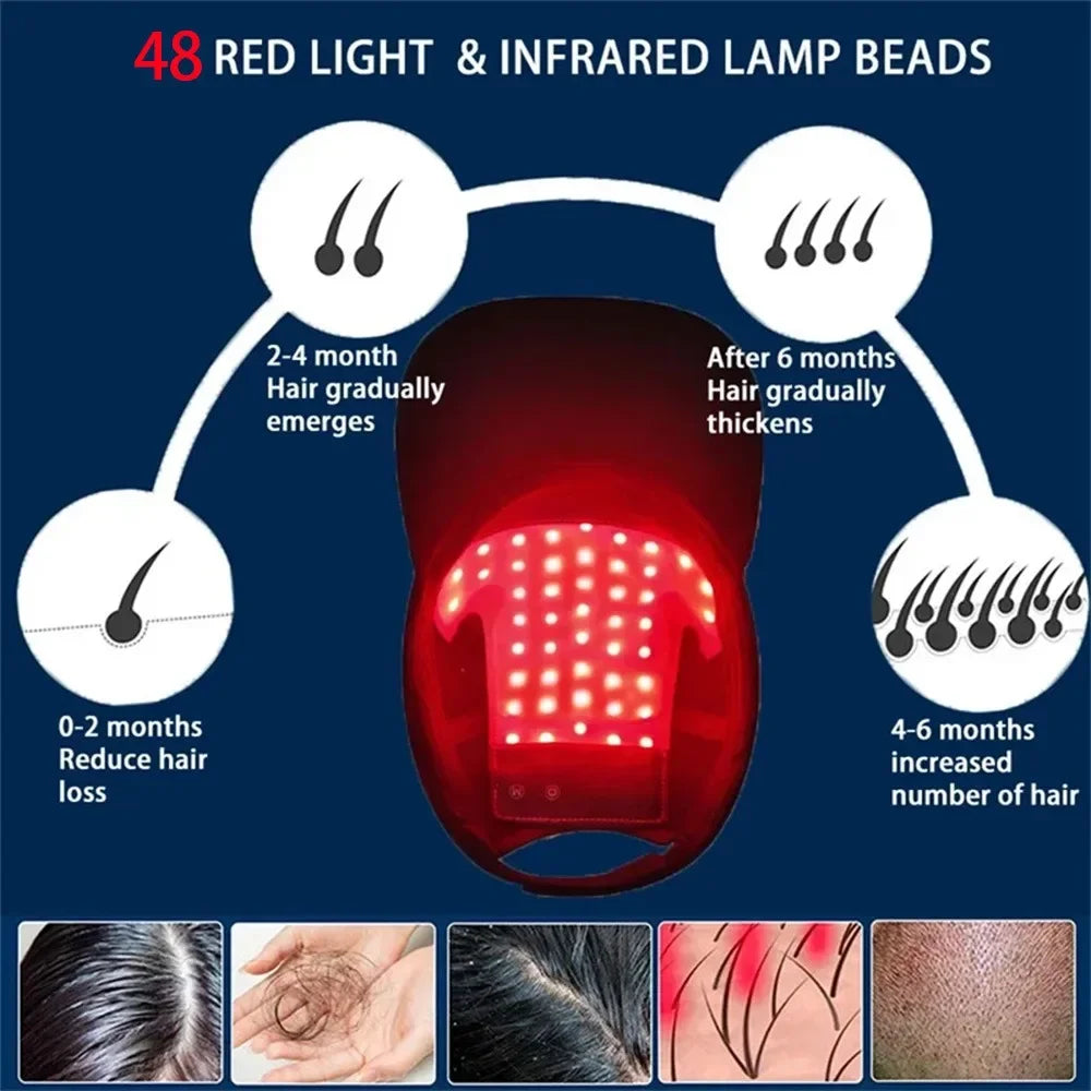 LuxCap Hair Regrowth