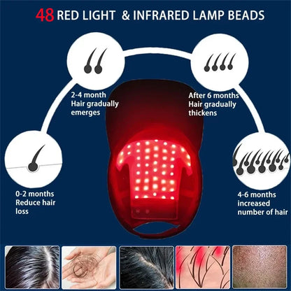 LuxCap Hair Regrowth