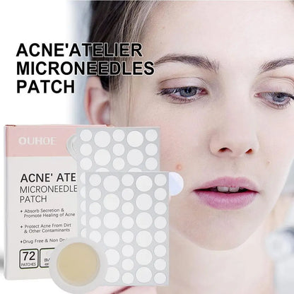 Micro-Needle Acne Patch