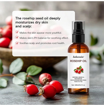 All In Rosehip