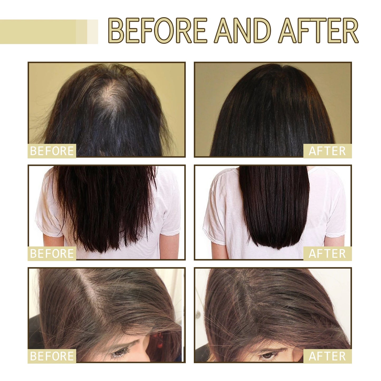 Rosemary Hair Growth Oil