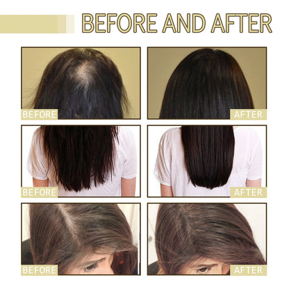 Rosemary Hair Growth Oil