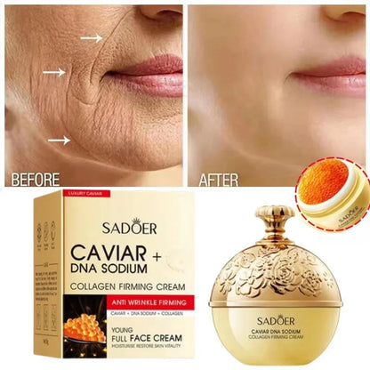 Caviar Lift